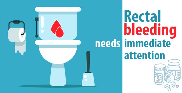 Rectal bleeding needs immediate attention